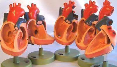 Set 5 human congenital malformation heart anatomical medical teaching 