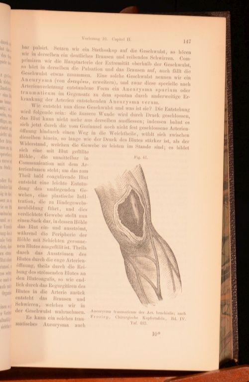 1876 Billroth Die Allgemeine Chirurgische Pathologie Und Therapie 50 