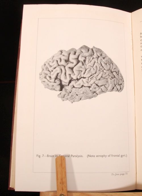 1944 PSYCHOLOGICAL MEDICINE Curran Guttman Illus