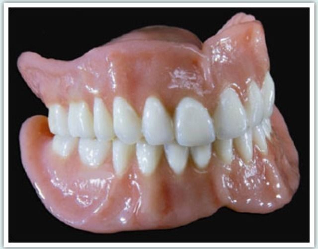 Dentures at EXTREME Discount Coupon