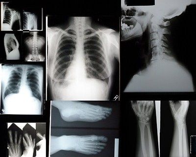 LOT 10 REAL HUMAN X RAYS X RAY Anatomy bones prop art steampunk design